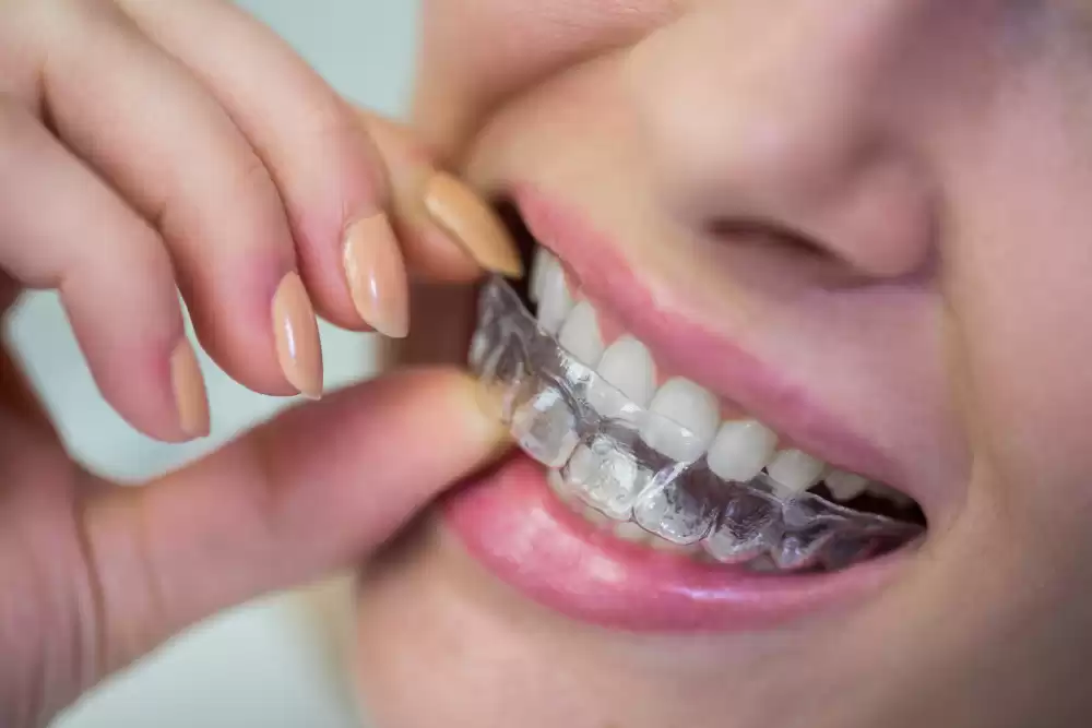 Orthodontic Treatment in Noida